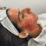 9 types of facials to treat your skin to the best treatments