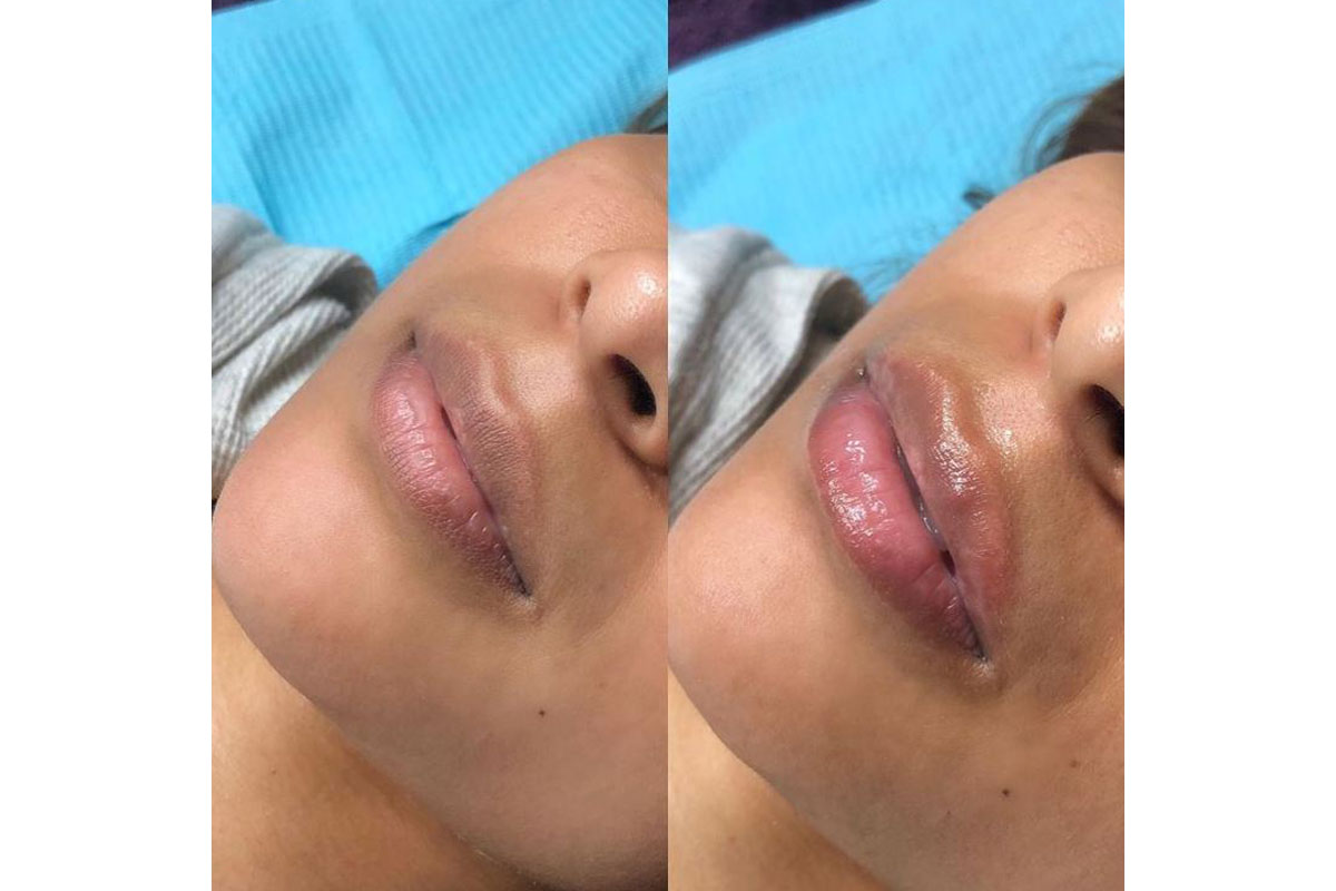 lips