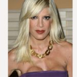 Celebrity Plastic Surgery – Before and After