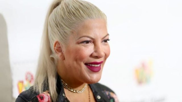 Celebrity Plastic Surgery – Before and After